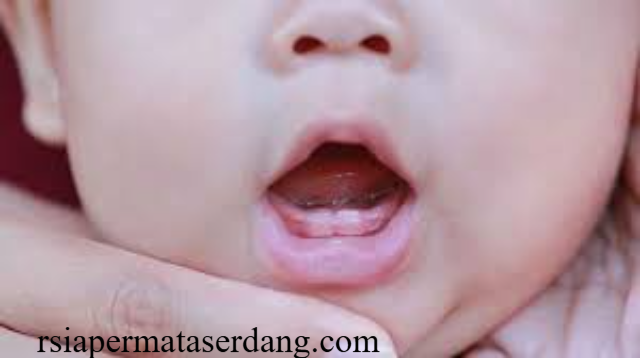 Tanda-tanda Bayi Tumbuh Gigi dan Cara Meredakan Rasa Sakitnya